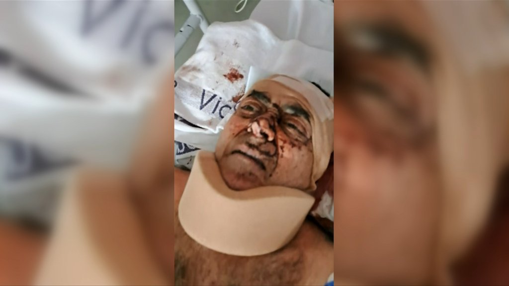 Africans charged after man allegedly shot and bashed with hammer in Melbourne home invasion