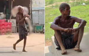 Two scenes of extreme poverty: a gaunt man walking while carrying a large bundle over his shoulder, and a shirtless, emaciated man sitting barefoot on a curb.