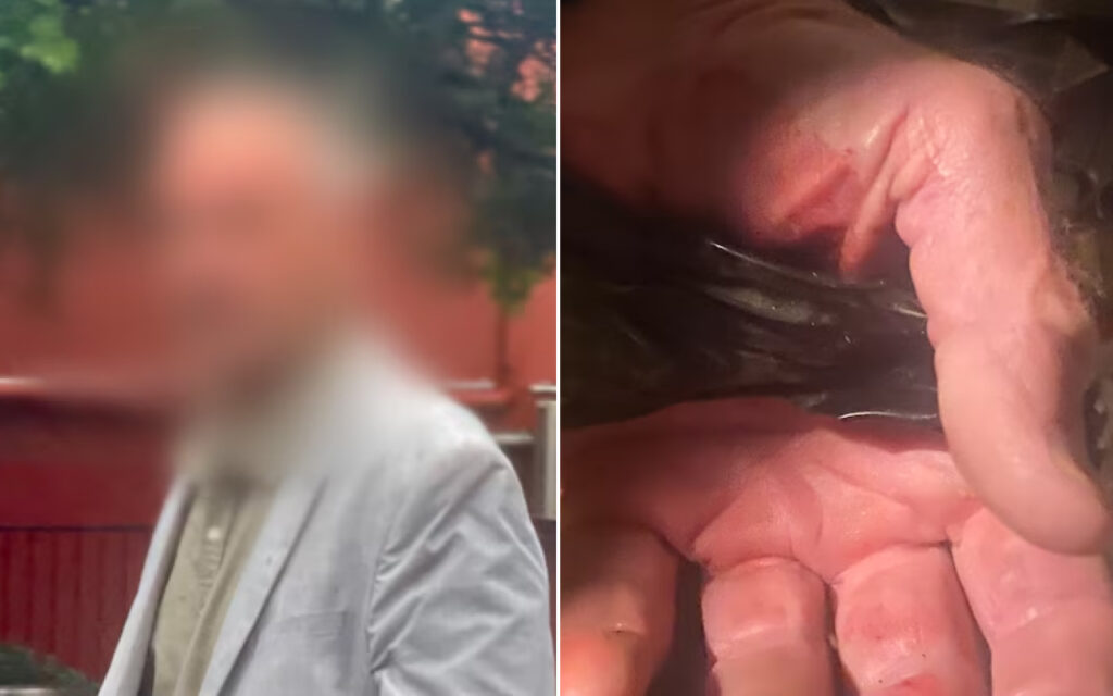 Left: blurred portrait of a person wearing a light jacket outdoors. Right: close-up of an adult male genitalia being held by fingers.