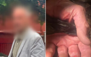 Left: blurred portrait of a person wearing a light jacket outdoors. Right: close-up of an adult male genitalia being held by fingers.